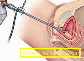 Цистоскопија бешике код жена