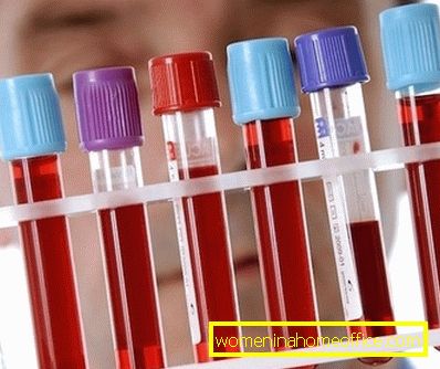 Тест крви у дијагностици леукемије код одраслих
